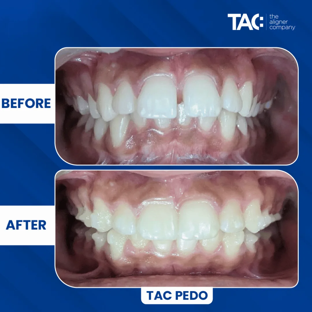 New tac images (2)